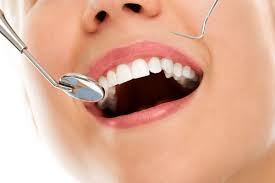 Dental Checkup